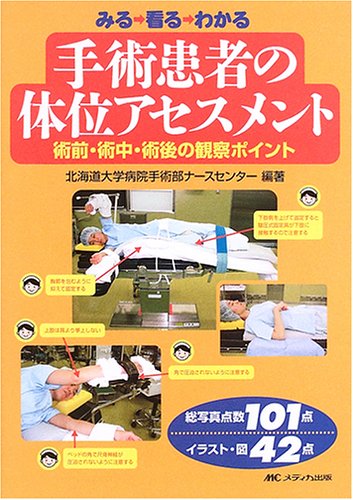みる 看る わかる手術患者の体位アセスメント―術前・術中・術後の観察ポイント
