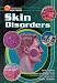 Books : Skin Disorders (21st Century Health and Wellness)