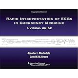rapid interpretation of ecgs in emergency medicine a visual guide