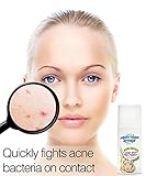Acne Serum Spot Treatment - Quickly fights acne causing bacteria on spot to treat acne breakouts, pimples, whiteheads and blackheads. Dissolves away p