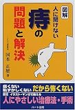 図解 人に聞けない痔の問題と解決
