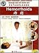 Hemorrhoids