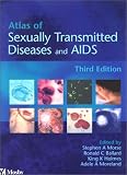 Atlas of Sexually Transmitted Diseases and AIDS