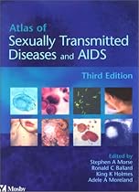 Atlas of Sexually Transmitted Diseases and AIDS