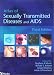 Books : Atlas of Sexually Transmitted Diseases and AIDS