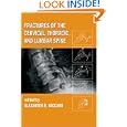 Fractures of the Cervical, Thoracic, and Lumbar Spine (Mechanical Engineering)