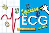 Flip and See ECG