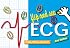 Flip and See ECG