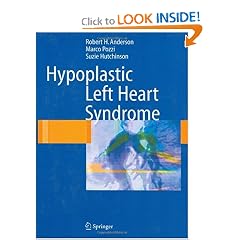 Hypoplastic Left Heart Syndrome by Robert H. Anderson, Marco Pozzi and Suzie Hutchinson