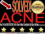 [SOLVED] How To Get Rid Of ACNE: All In One Articles Compilation By Mary McAdoo [Newly Revised]