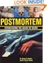Postmortem: Establishing the Cause of Death