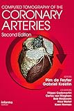 Computed tomography of the coronary arteries