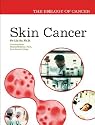 Skin Cancer (The Biology of Cancer)