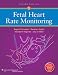 Fetal Heart Rate Monitoring
