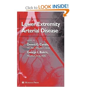 51Qy2a3pi1L. BO2,204,203,200 PIsitb sticker arrow click,TopRight,35, 76 AA300 SH20 OU01  Medicine Book : Lower Extremity Arterial Disease (Clinical Hypertension and Vascular Diseases) 