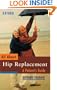All About Hip Replacement: A Patient's Guide