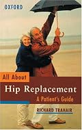 All About Hip Replacement: A Patient's Guide