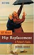All About Hip Replacement: A Patient's Guide