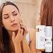 Acne Treatment for Adults & Teens with Retinol, Salicylic Acid, Niacinamide, Vitamin C and Hyaluronic Acid -Skin Clearing, Anti aging, Cystic Pimple & Blemish Control