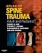 Atlas of Spine Trauma with CD-ROM: Adult & Pediatric, 1e