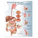 Gastroesophageal Disorders and Digestive Anatomy Chart Unmounted