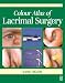 Color Atlas of Lacrimal Surgery