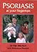 Books : Psoriasis at Your Fingertips (At Your Fingertips)