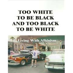 Too White to Be Black and Too Black to Be White: Living with Albinism by Lee G. Edwards