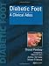 Diabetic Foot: A Clinical Atlas