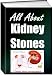 image 4kidney stones - All About Kidney Stones