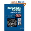 Interventional Oncology: Principles and Practice