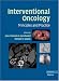 Interventional Oncology: Principles and Practice