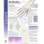 Arthritis: Gray's Anatomy Poster Series (Gray's Anatomy Poster) by D. John Dickson