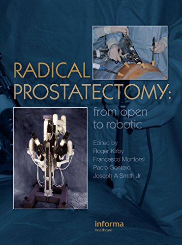 Radical Prostatectomy: From Open to Robotic