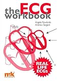 The ECG Workbook
