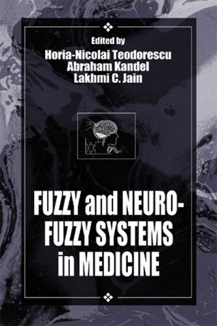 Fuzzy-Logic