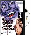 Dracula Has