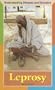 Leprosy (Understanding Diseases and Disorders)