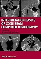 Interpretation Basics of Cone Beam Computed Tomography Interpretation Basics of Cone Beam Computed Tomography