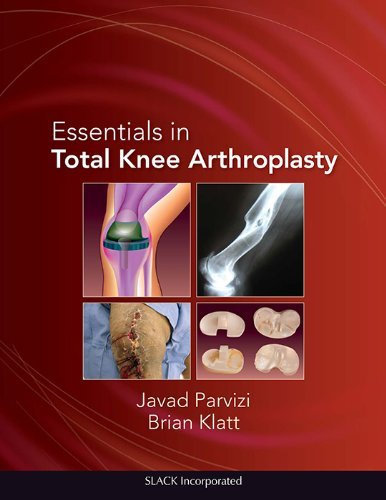 By Javad Parvizi MD Essentials in Total Knee Arthroplasty (Parvizi, Essentials in Total Knee Arthroplasty) (1st First Edition) [Hardcover]