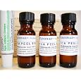 Tca 100%, 50%, 25% Chemical Peel Trio Professional Grade Facial Peel - .5 Fl Oz 15 Ml Each. For Acne Treatments, Blackheads, Acne Scars, And Anti Aging. Includes Antibacterial Ointment To Protect Treated Skin