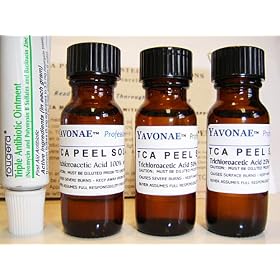 TCA 100%, 50%, 25% Chemical Peel Trio Professional Grade Facial Peel – .5 fl oz 15 ml each. For Acne Treatments, Blackheads, Acne Scars, and Anti Aging. Includes Antibacterial Ointment to Protect Treated Skin