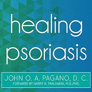 Healing Psoriasis: The Natural Alternative