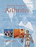 The facts about arthritis