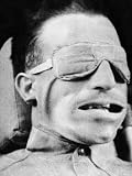 Facial Distortion of Volunteer in 300 Mph Wind Bail Out Experiment Conducted by US Navy Photographic Poster Print, 12x16