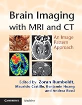Brain Imaging with MRI and CT: An Image Pattern Approach (Cambridge Medicine (Hardcover)) Brain Imaging with MRI and CT: An Image Pattern Approach (Cambridge Medicine (Hardcover))