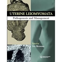 Uterine Leiomyomas: Pathogenesis and Management by Ivo Brosens