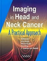 Imaging of Head and Neck Cancer