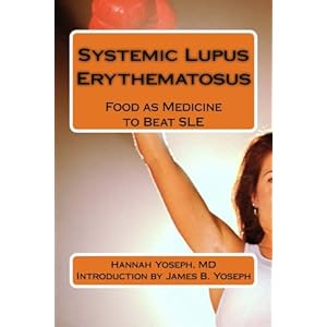 Systemic Lupus Erythematosus: Food as Medicine to Beat SLE