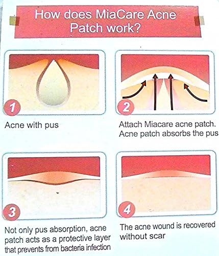 Acne Dressing Patch for Acne Relief ,Acne Absorbing Cover for Day 3 Pack (Pack of 12 Pcs.)